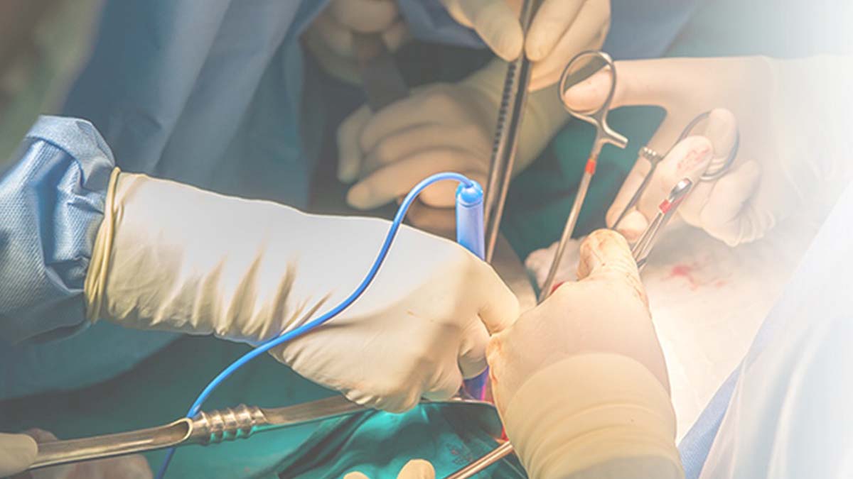 General Surgery Image